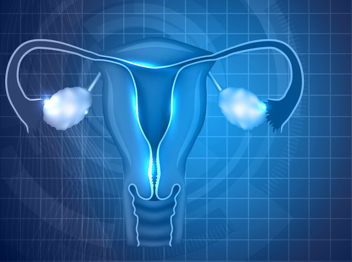 Results from the phase 3 NINJA trial indicated that chemotherapy agents such as gemcitabine or pegylated liposomal doxorubicin yielded better survival outcomes vs nivolumab among patients with platinum-resistant ovarian cancer.