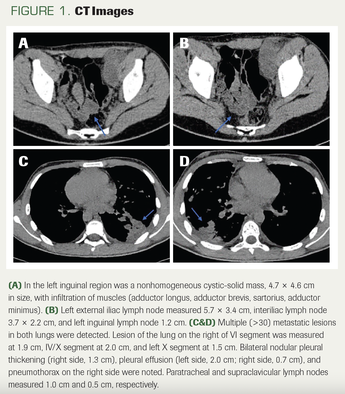 FIGURE 1. CT Images
