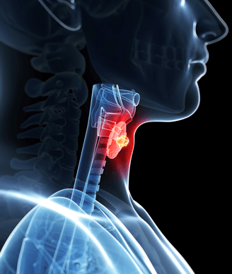 Results from a phase 1 trial evaluating the CAR T-cell therapy, AIC100, in relapsed/refractory thyroid cancer support the FDA’s RMAT designation.