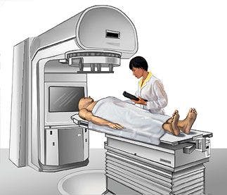 A clinical trial evaluated the ability of oxygen-enhanced MRI-derived hypoxic volume to detect radiotherapy-induced hypoxia modification.