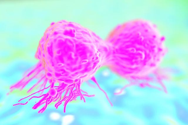 Capivasertib's safety profile in the CAPItello-290 trial was comparable with prior reports of the agent in advanced triple-negative breast cancer.