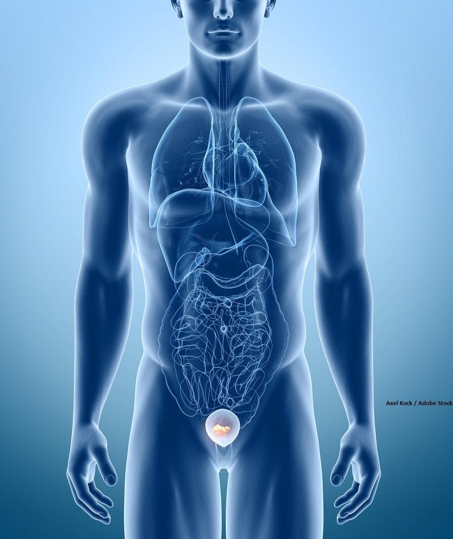 Durvalumab improved efficacy in patients with muscle-invasive bladder cancer.