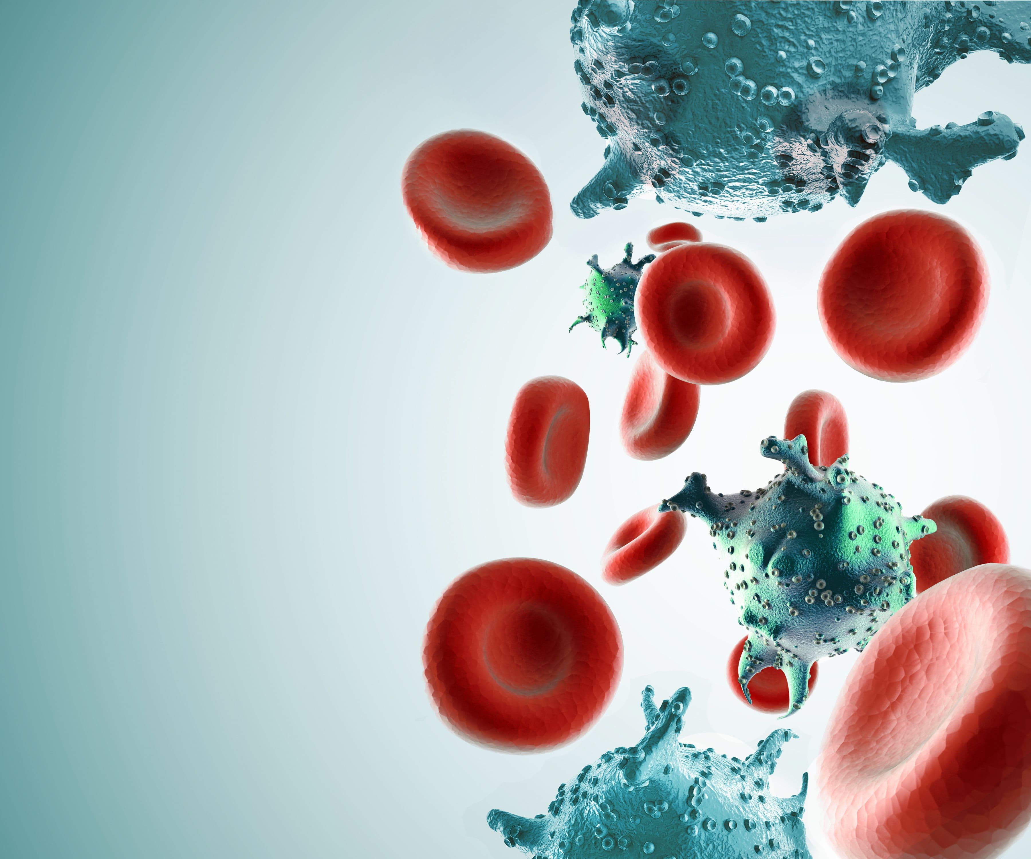 acute myeloid leukemia