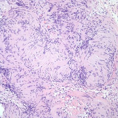 Patient Presents With Neck Lesion 