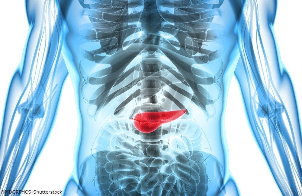 Research shows that patients with pancreatic ductal adenocarcinoma are frequently understaged prior to surgery.