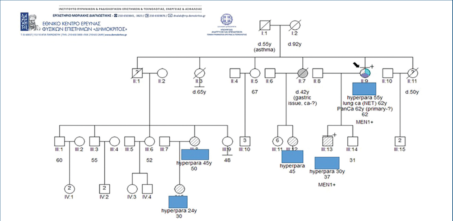 FIGURE 6. Patients’ genealogic tree. The patient’s older son was diagnosed with hypercalcemia at 30 years old. Both he and the patient are carriers of the pathologic variant in MEN1 gene c.959CG (p.Pro320Arg) in exon 7.