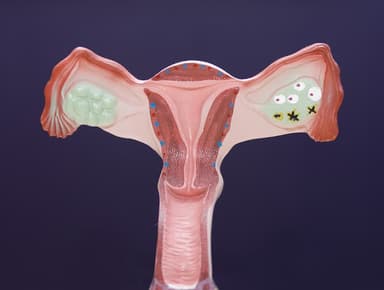 A new surgical option of uterine transposition may help preserve fertility for women who have cancers of the pelvic region. 