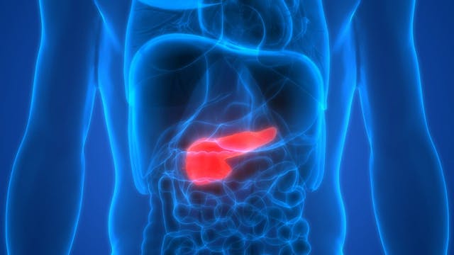 Data from the phase 2 OPTIMIZE-1 trial demonstrate efficacy with mitazalimab/mFOLFIRINOX in patients with metastatic pancreatic adenocarcinoma.